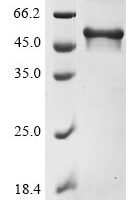 Human Microtubule-associated protein tau (MAPT) Recombinant Protein, N-10His - BioCrest Sci