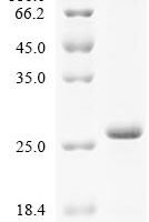 Rat Sodium channel protein type 9 subunit alpha (Scn9a), partial Recombinant Protein - BioCrest Sci