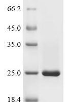 Human Eukaryotic translation initiation factor 4E-binding protein 1 (EIF4EBP1) Recombinant Protein, C-His - BioCrest Sci