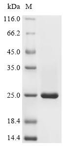Human Eukaryotic translation initiation factor 4E-binding protein 1 (EIF4EBP1) Recombinant Protein, C-His, Homo sapiens (Human), E.coli, C-terminal 6xHis-tagged, 19.4 kDa, purity >≥ 85% as determined by SDS-PAGE.