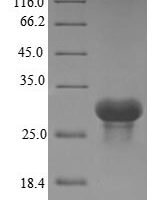 Human Complement C1q subcomponent subunit A (C1QA) Recombinant Protein, N-10His/C-Myc, aa 23–245, E.coli - BioCrest Sci