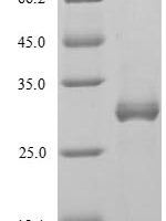 Influenza A virus Non-structural protein 1 (NS) Recombinant Protein, N-His, aa 1–237, E.coli - BioCrest Sci