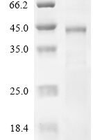 Human Coagulation factor XII (F12), partial Recombinant Protein - BioCrest Sci