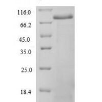 Human Spectrin alpha chain, non-erythrocytic 1 (SPTAN1), partial Recombinant Protein - BioCrest Sci