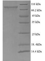 Human Trichoplein keratin filament-binding protein (TCHP) Recombinant Protein - BioCrest Sci
