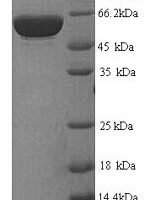 Human Platelet glycoprotein Ib alpha chain (GP1BA), partial Recombinant Protein, N-His, aa 17–531, Yeast - BioCrest Sci