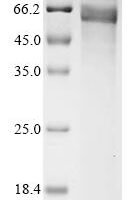 Human Leucine-rich repeat-containing G-protein coupled receptor 5 (LGR5), partial Recombinant Protein, C-hFc1, aa 22–561 - BioCrest Sci