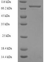 Human Mixed lineage kinase domain-like protein (MLKL) Recombinant Protein, N-His-SUMO - BioCrest Sci