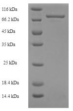 Human Mixed lineage kinase domain-like protein (MLKL) Recombinant Protein, N-His-SUMO, Homo sapiens (Human), E.coli, N-terminal 6xHis-SUMO-tagged, 70.5 kDa, purity >≥ 90% as determined by SDS-PAGE.