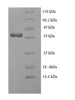 Epstein-Barr virus Lytic switch protein BZLF1 (BZLF1) Recombinant Protein, N-His-SUMO - BioCrest Sci