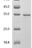 Macaca fascicularis Kallikrein-related peptidase 2 (KLK2) Recombinant Protein, C-His - BioCrest Sci