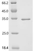 Human Aspartyl/asparaginyl beta-hydroxylase (ASPH), partial Recombinant Protein, C-His - BioCrest Sci