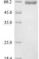 Human Hyaluronidase PH-20 (SPAM1), partial Recombinant Protein - BioCrest Sci