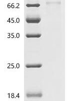 Autographa californica nuclear polyhedrosis virus Major envelope glycoprotein (GP64), partial Recombinant Protein, N-His - BioCrest Sci