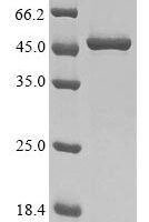 Gallus gallus Heat shock 70 kDa protein, partial Recombinant Protein - BioCrest Sci
