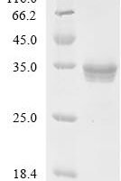 C-terminal hFc1-tagged Recombinant Protein - BioCrest Sci