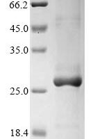 Dog C-C motif chemokine 17 (CCL17) Recombinant Protein, N-His-KSI - BioCrest Sci