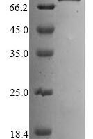 Human Kelch-like ECH-associated protein 1 (KEAP1) Recombinant Protein, N-His-SUMO - BioCrest Sci
