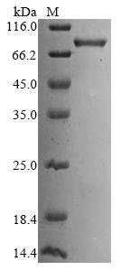 Human Kelch-like ECH-associated protein 1 (KEAP1) Recombinant Protein, N-His-SUMO, Homo sapiens (Human), E.coli, N-terminal 6xHis-SUMO-tagged, 82.6 kDa, purity >≥ 85% as determined by SDS-PAGE.