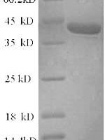 Rat Alpha-synuclein (Snca) Recombinant Protein - BioCrest Sci