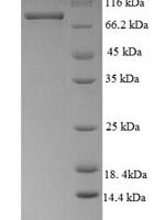 Human Desmoglein-3 (DSG3), partial Recombinant Protein, N-His-SUMO, Extracellular Domain - BioCrest Sci