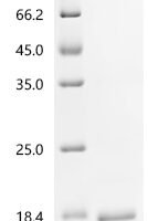 Clostridium botulinum Hemagglutinin component of the neurotoxin complex (ha17) Recombinant Protein - BioCrest Sci