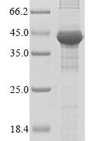 Human Fatty acid synthase (FASN), partial Recombinant Protein, N-His - BioCrest Sci