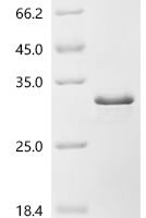 Human Lysozyme C (LYZ) Recombinant Protein, N-His-SUMOstar - BioCrest Sci