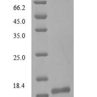 Severe acute respiratory syndrome coronavirus 2 Replicase polyprotein 1ab (rep), partial Recombinant Protein, C-10His - BioCrest Sci