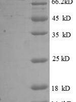 Human 5'-nucleotidase (NT5E), partial Recombinant Protein - BioCrest Sci