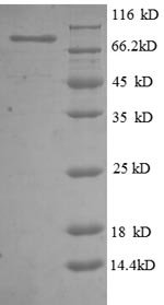 Human 5'-nucleotidase (NT5E), partial Recombinant Protein, Homo sapiens (Human), E.coli, N-terminal GST-tagged, 84.6 kDa, purity >≥ 90% as determined by SDS-PAGE.