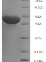 Human Butyrophilin subfamily 3 member A1 (BTN3A1), partial Recombinant Protein, N-His-SUMO - BioCrest Sci