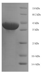 Human Butyrophilin subfamily 3 member A1 (BTN3A1), partial Recombinant Protein, N-His-SUMO, Homo sapiens (Human), E.coli, N-terminal 6xHis-SUMO-tagged, 40.2 kDa, purity >≥ 90% as determined by SDS-PAGE.