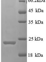Human Hepatitis A virus cellular receptor 2 (HAVCR2), partial Recombinant Protein, N-His, aa 22–202, E.coli - BioCrest Sci