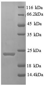 Human Hepatitis A virus cellular receptor 2 (HAVCR2), partial Recombinant Protein, N-His, aa 22–202, E.coli, Homo sapiens (Human), E.coli, N-terminal 6xHis-tagged, 24.0 kDa, purity >≥ 90% as determined by SDS-PAGE.