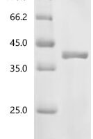 Human cytomegalovirus Enhanced green fluorescent protein (egfp) Recombinant Protein, N-CD81/C-10His - BioCrest Sci