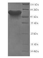 Mouse Leucine-rich repeat and immunoglobulin-like domain-containing nogo receptor-interacting protein 1 (Lingo1), partial Recombinant Protein, N-His, aa 37–555, Yeast - BioCrest Sci