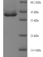 Human Apoptosis-enhancing nuclease (AEN), partial Recombinant Protein, N-His-SUMO - BioCrest Sci