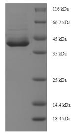 Human Apoptosis-enhancing nuclease (AEN), partial Recombinant Protein, N-His-SUMO, Homo sapiens (Human), E.coli, N-terminal 6xHis-SUMO-tagged, 40.1 kDa, purity >≥ 90% as determined by SDS-PAGE.