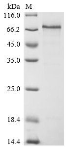 Human Thrombomodulin (THBD), partial Recombinant Protein, Homo sapiens (Human), E.coli, N-terminal 6xHis-SUMO-tagged, 65.0 kDa, purity >≥ 85% as determined by SDS-PAGE.