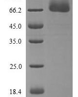 Human Proto-oncogene c-Rel (REL), partial Recombinant Protein, N-His, aa 3–616, Yeast - BioCrest Sci