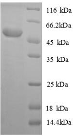 Mouse Acyl-protein thioesterase 1 (Lypla1) Recombinant Protein, N-GST, Mus musculus (Mouse), E.coli, N-terminal GST-tagged, 51.7 kDa, purity >≥ 90% as determined by SDS-PAGE.