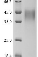 Human Interferon gamma receptor 1 (IFNGR1), partial Recombinant Protein, C-His-Flag - BioCrest Sci