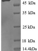 Mouse Alkaline phosphatase, tissue-nonspecific isozyme (Alpl), partial Recombinant Protein - BioCrest Sci