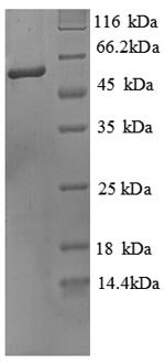 Mouse Alkaline phosphatase, tissue-nonspecific isozyme (Alpl), partial Recombinant Protein, Mus musculus (Mouse), E.coli, N-terminal 6xHis-tagged, 57.4 kDa, purity >≥ 90% as determined by SDS-PAGE.