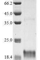 Daboia palaestinae Disintegrin viperistatin Recombinant Protein, C-His-Myc - BioCrest Sci