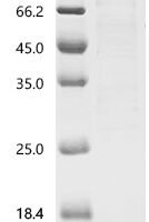 Human DNA ligase 1 (LIG1) Recombinant Protein, C-GST - BioCrest Sci
