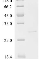 Enterocloster bolteae 90A9 Penicillin-binding protein 1A, partial Recombinant Protein - BioCrest Sci