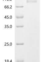 Porcine epidemic diarrhea virus Spike glycoprotein(S), partial Recombinant Protein - BioCrest Sci