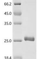 Human immunodeficiency virus type 1 group M subtype B Protein Rev (rev) Recombinant Protein - BioCrest Sci